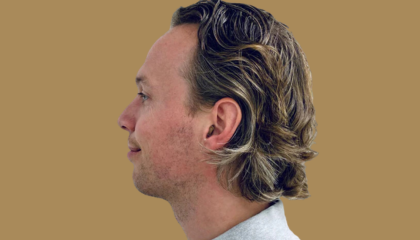 The Importance of Hearing Aids for Your Social Life and Mental Health